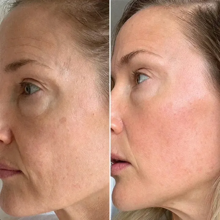 GloraMD Before After 1