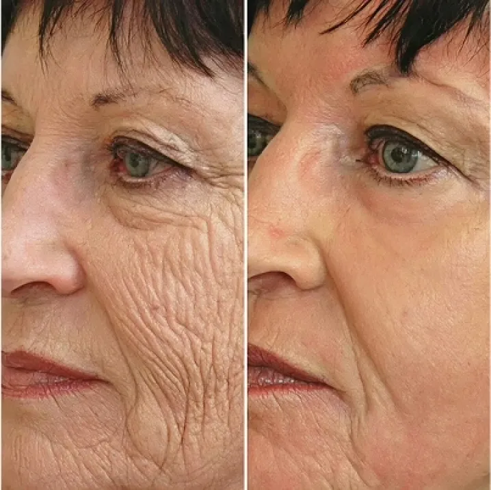 GloraMD Before After 2