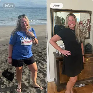 Karen Webb before and after WellMedr